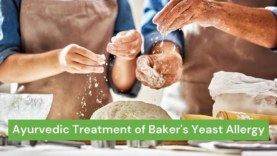 Baker's Yeast Allergy - Causes, Symptoms, and Ayurvedic Treatment