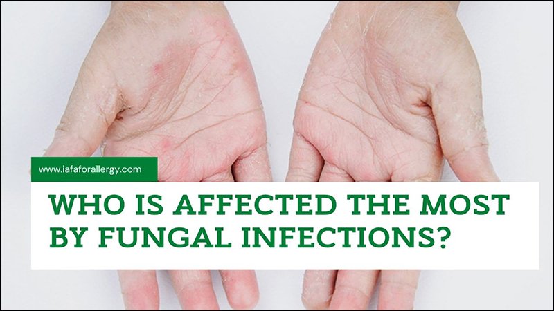 Fungal Infections