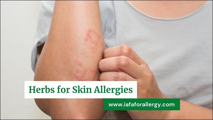Treatment of Skin Allergies