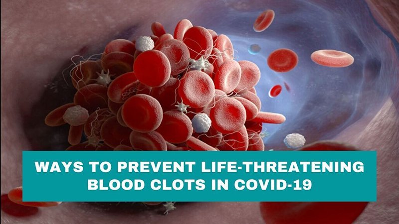 Ways to Prevent Life-Threatening Blood Clots in Covid-19