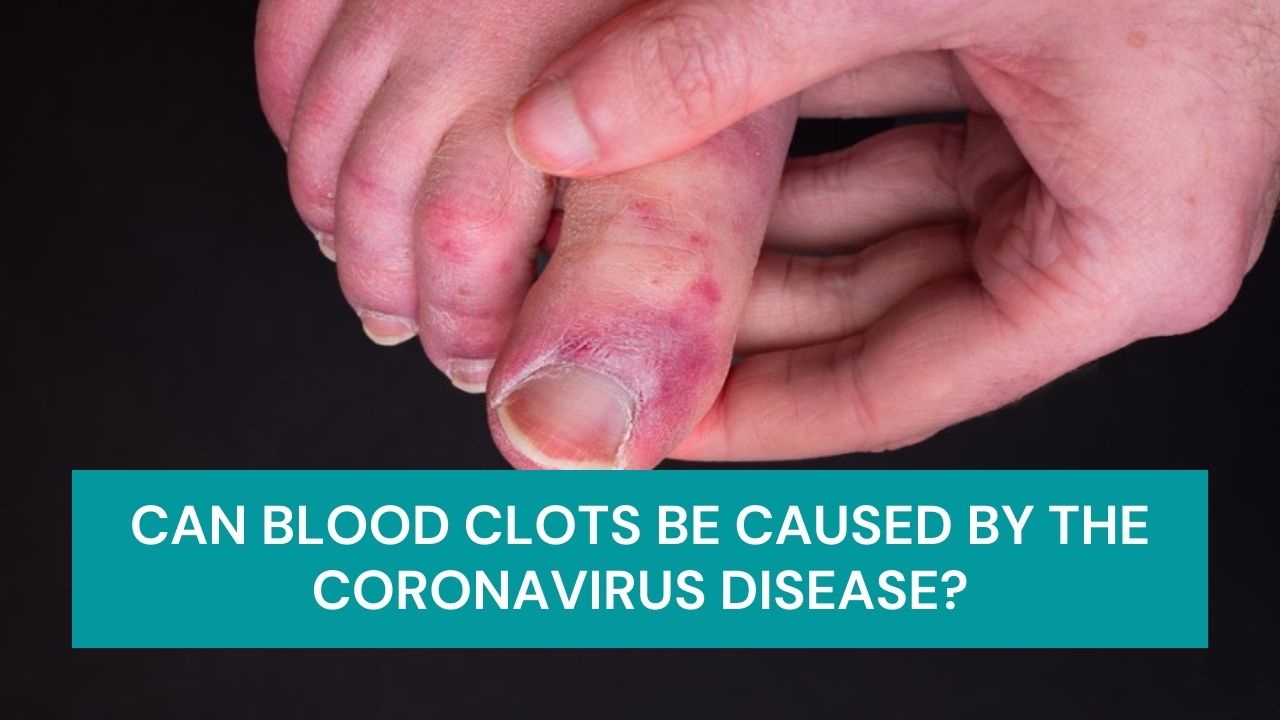 Blood Clotting in COVID-19