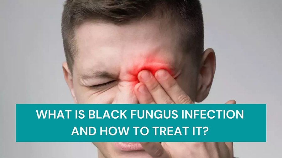 Treatment of Black Fungus Infection