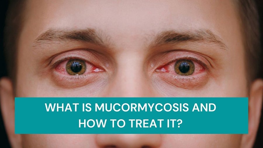 Treatment of Mucormycosis