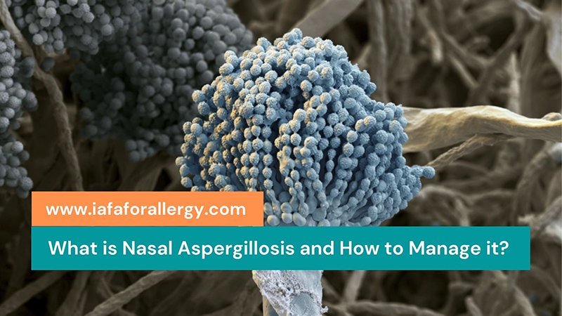 Management of Nasal Aspergillosis