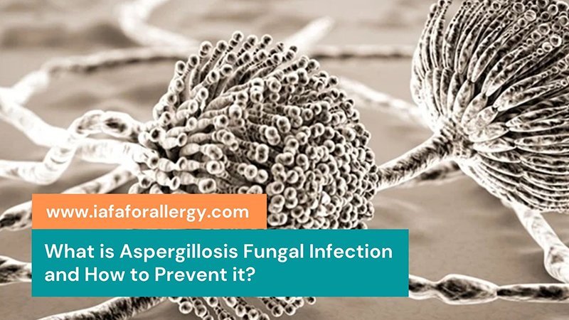 Prevention of Aspergillosis Fungal Infection