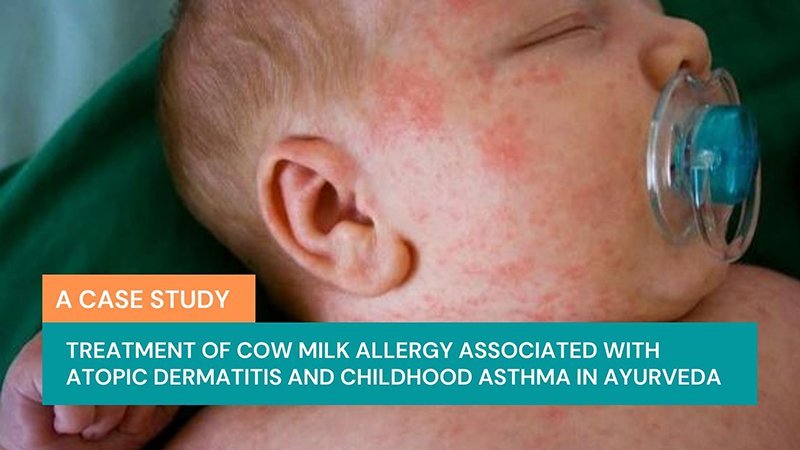 Treatment of Cow Milk Allergy