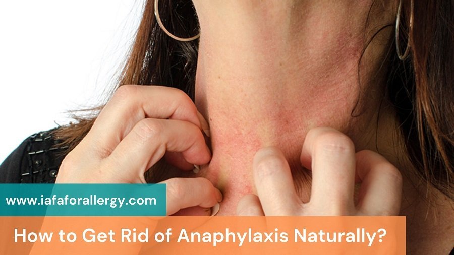 Get Rid of Anaphylaxis Naturally