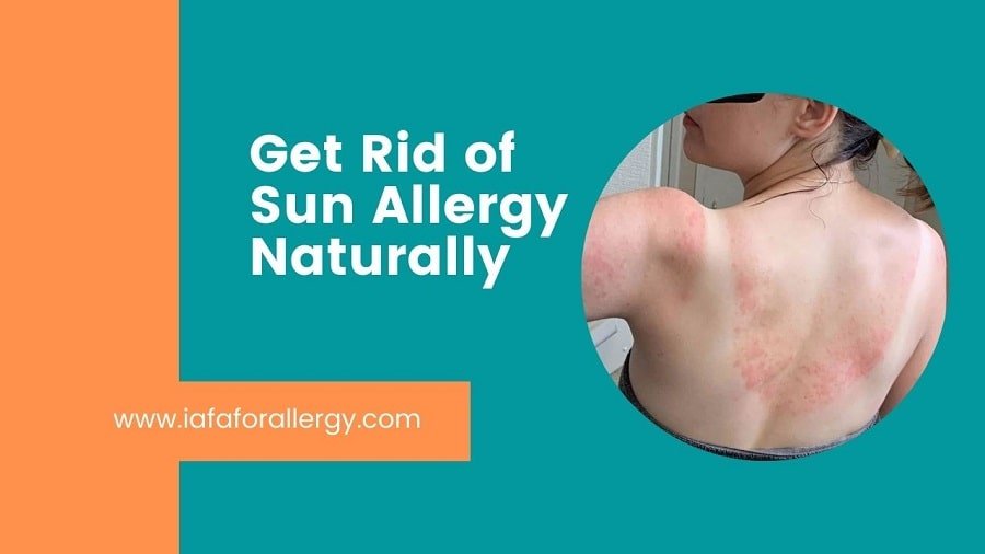 Get Rid of Sun Allergy Naturally