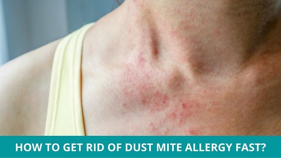 Get Rid of Dust Mite Allergy Fast