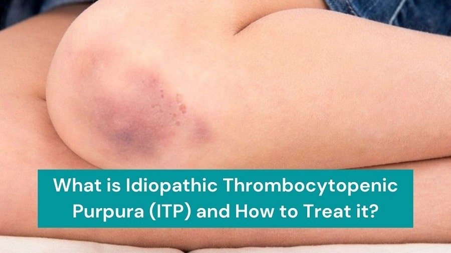 Treatment of Idiopathic Thrombocytopenic Purpura