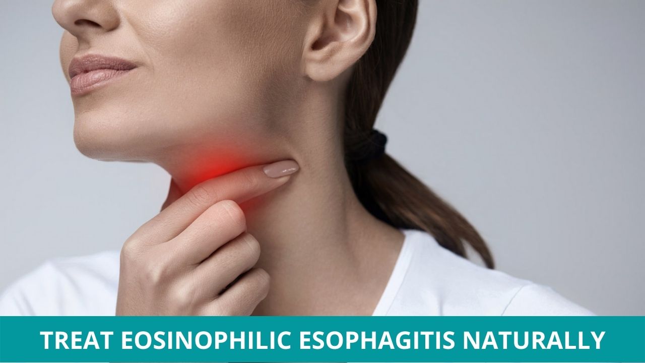 Treat Eosinophilic Esophagitis Naturally