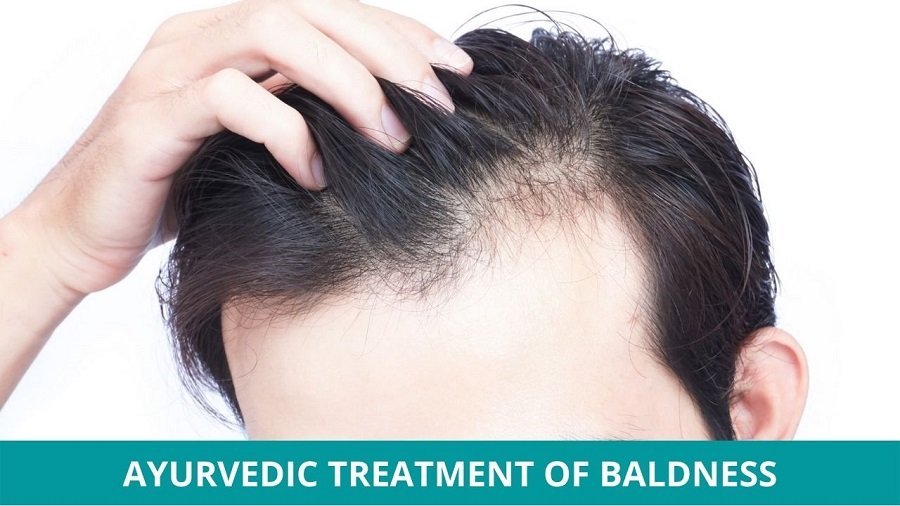 Ayurvedic Treatment of Baldness