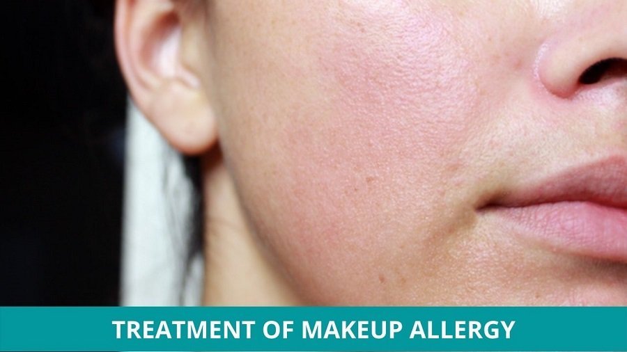 Ayurvedic Treatment of Makeup Allergy