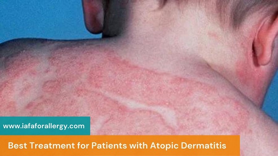 Ayurveda is a traditional medicinal practice and the best treatment option for patients with atopic dermatitis. It is originally found in India thousands of years ago.