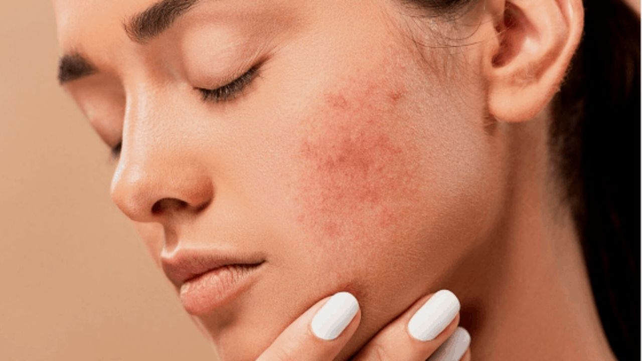 Ayurvedic Treatment of Skin Diseases