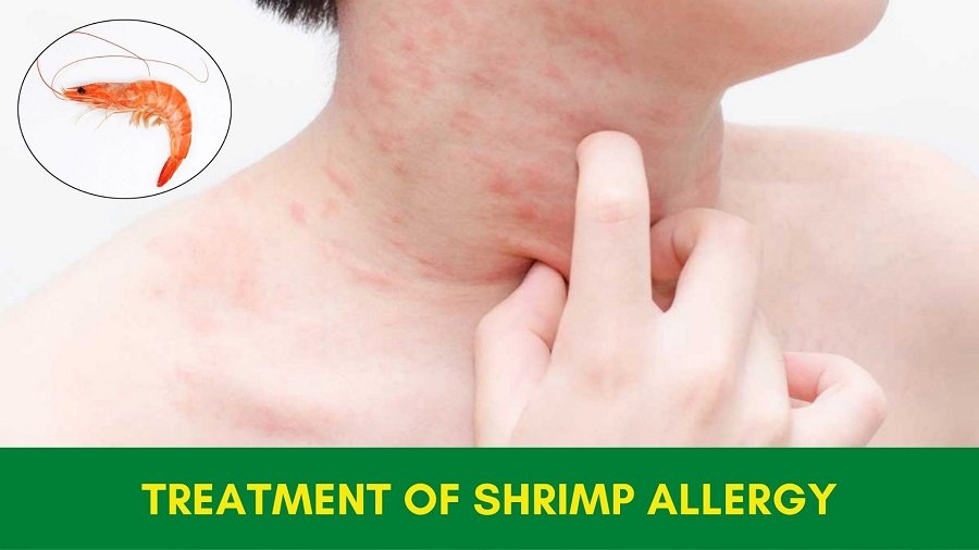 Ayurvedic Treatment of Shrimp Allergy