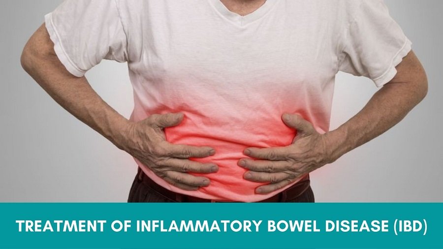 Treatment of Inflammatory Bowel Disease (IBD)