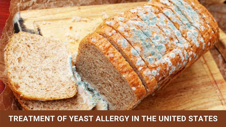 Treatment of Yeast Allergy in the United States