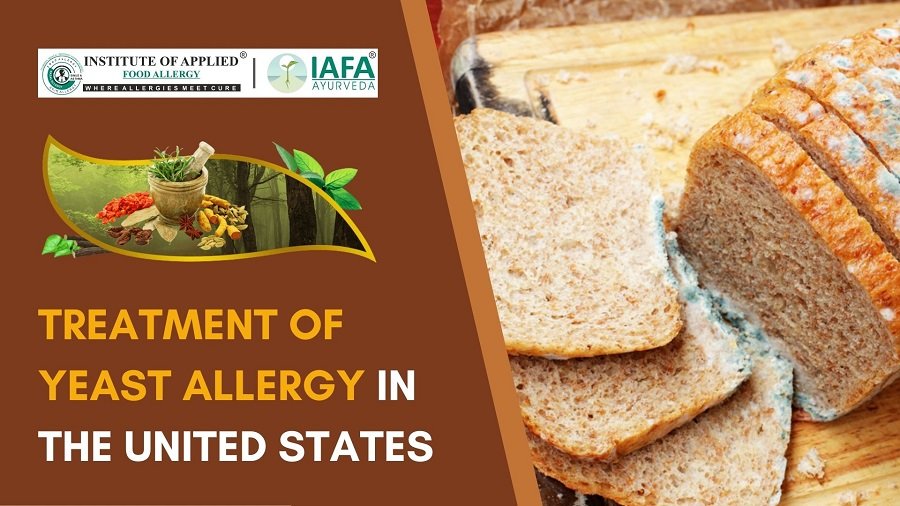 Treatment of Yeast Allergy in the United States