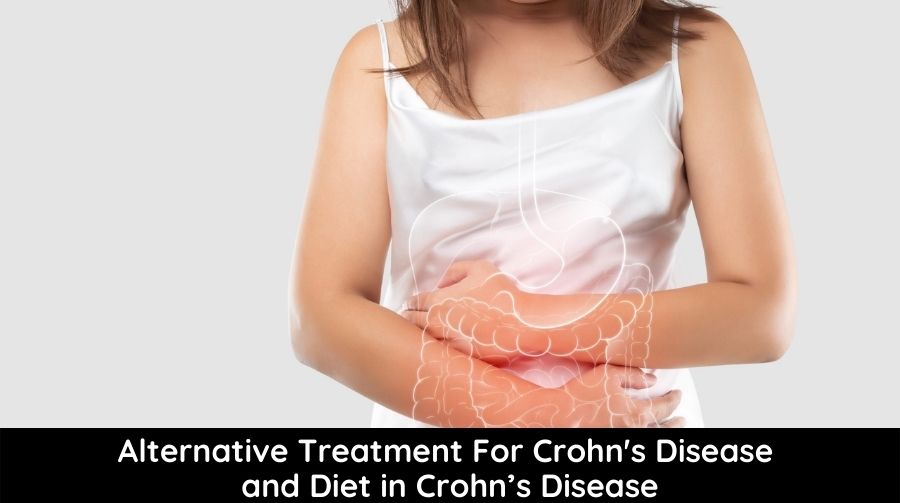 Alternative Treatment for Crohn's Disease and Diet in Crohn’s Disease