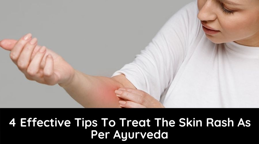 Tips To Treat The Skin Rash As Per Ayurveda