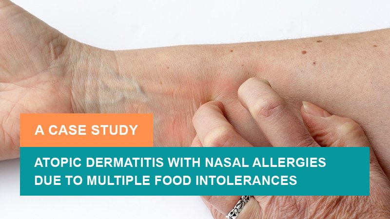 Successful Ayurvedic Treatment of Atopic Dermatitis with Nasal Allergies due to Multiple Food Intolerances - A Case Study