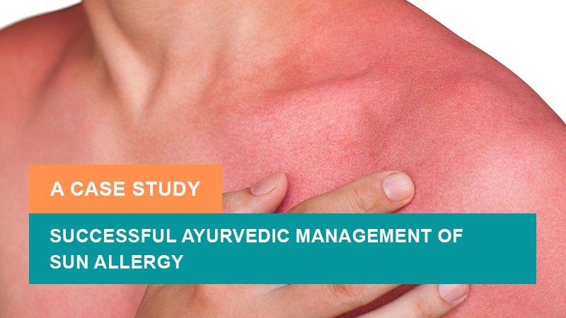 Successful Ayurvedic Management of Sun Allergy - A Case Study