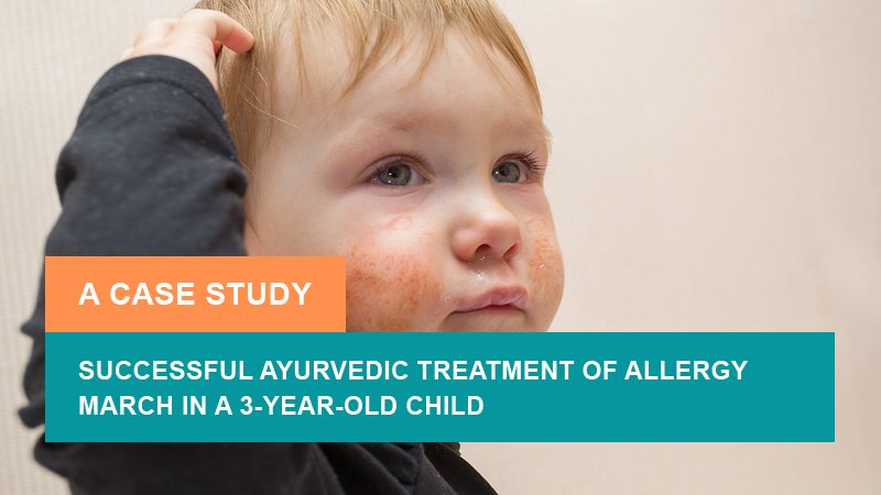 Successful Ayurvedic Treatment of Allergy March in a 3-Year-Old Child - A Case Study