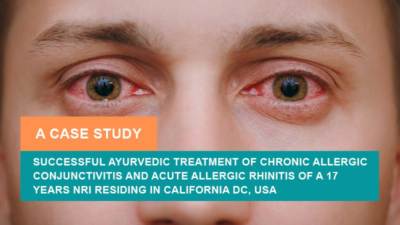 Successful Ayurvedic Treatment of Chronic Allergic Conjunctivitis and Acute Allergic Rhinitis - A Case Study