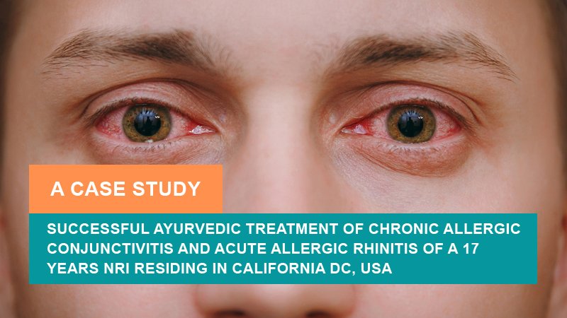 Successful Treatment of Chronic Allergic Conjunctivitis