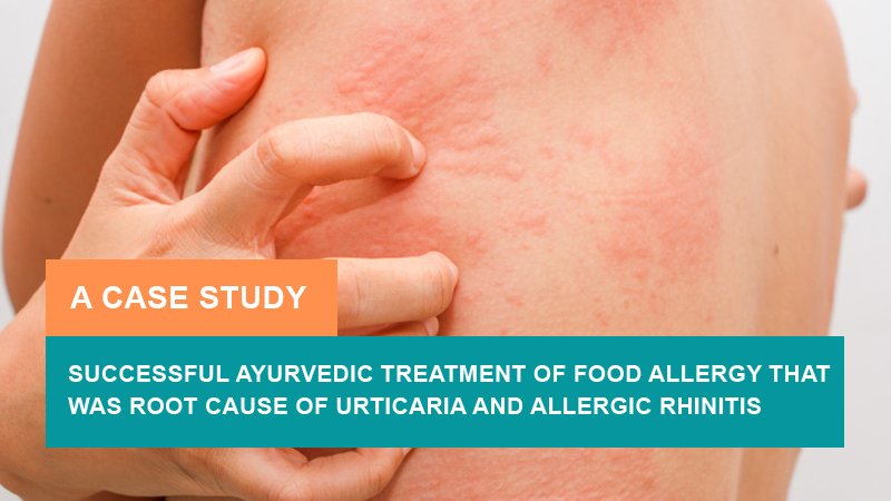 Successful Ayurvedic Treatment of Food Allergy, Urticaria, and Allergic Rhinitis - A Case Study