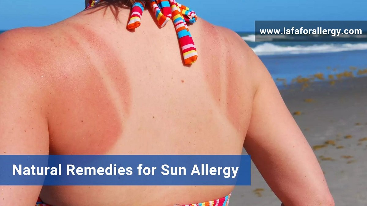 Natural Remedies for Sun Allergy - Effective Treatment by IAFA®