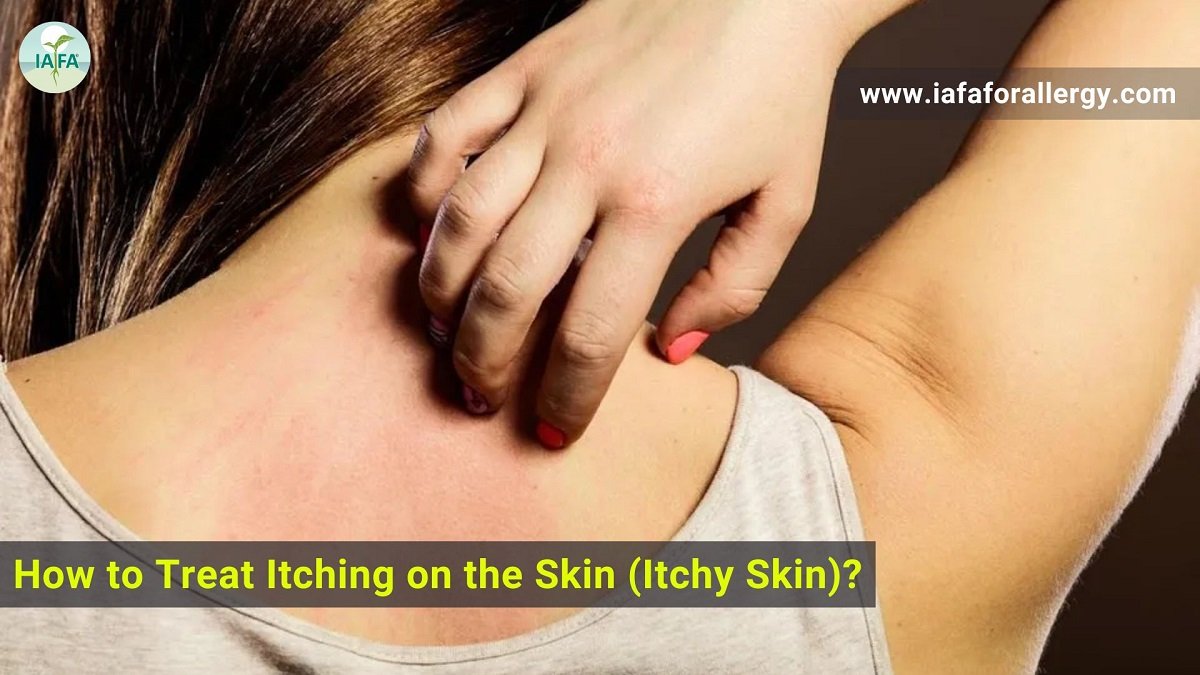 How to Treat Itching on the Skin (Itchy Skin)?