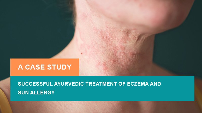 Successful Ayurvedic Treatment of Eczema and Sun Allergy - A Case Study
