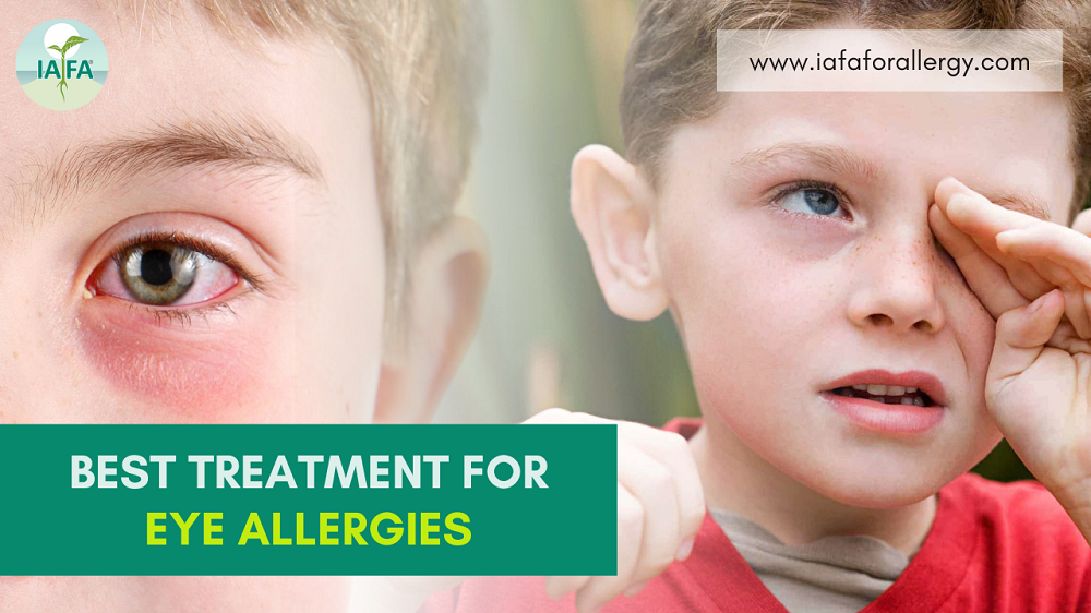 What is the Best Treatment for Eye Allergies?