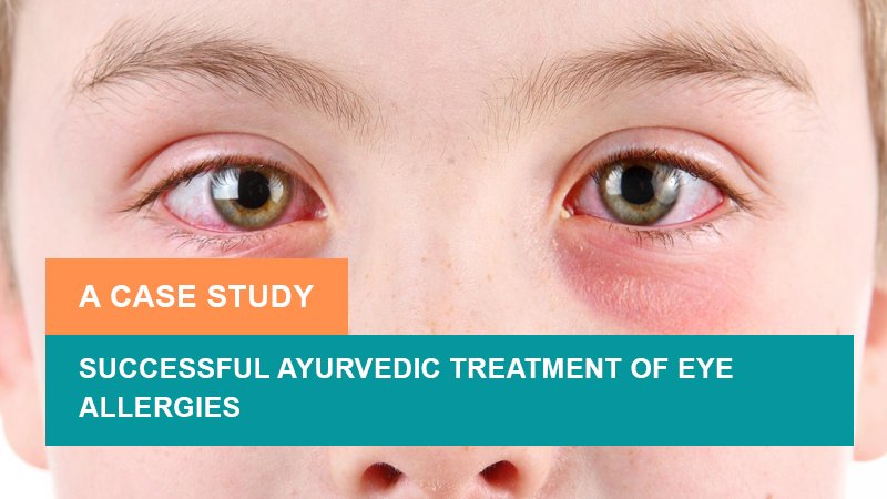 Successful Ayurvedic Treatment of Eye Allergies - A Case Study