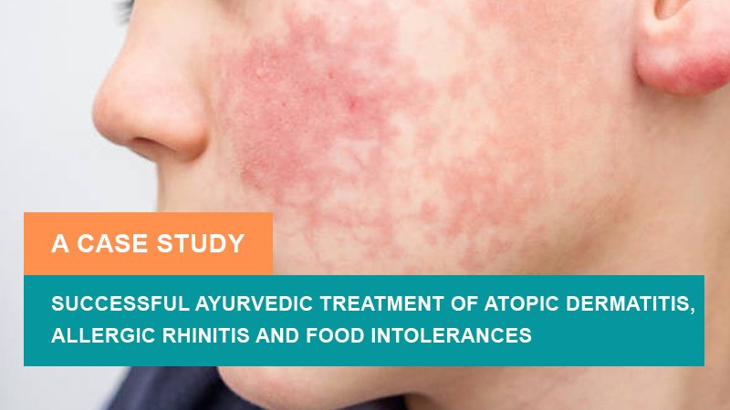 Successful Ayurvedic Treatment of Atopic Dermatitis, Allergic Rhinitis and Food Intolerances – A Case Study