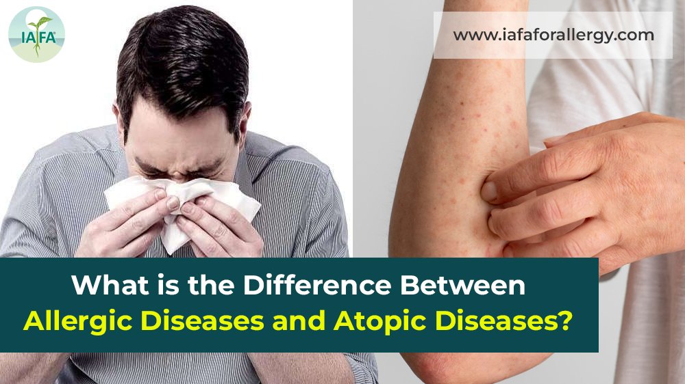 Difference Between Allergic Diseases and Atopic Diseases
