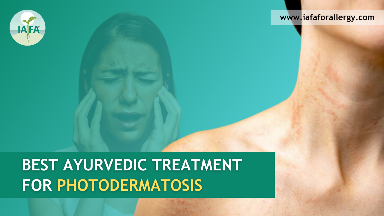 Best Ayurvedic Treatment for Photodermatosis