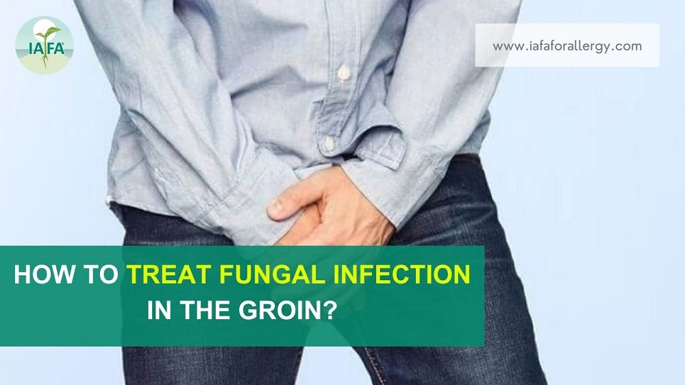 How to Treat Fungal Infection in the Groin?