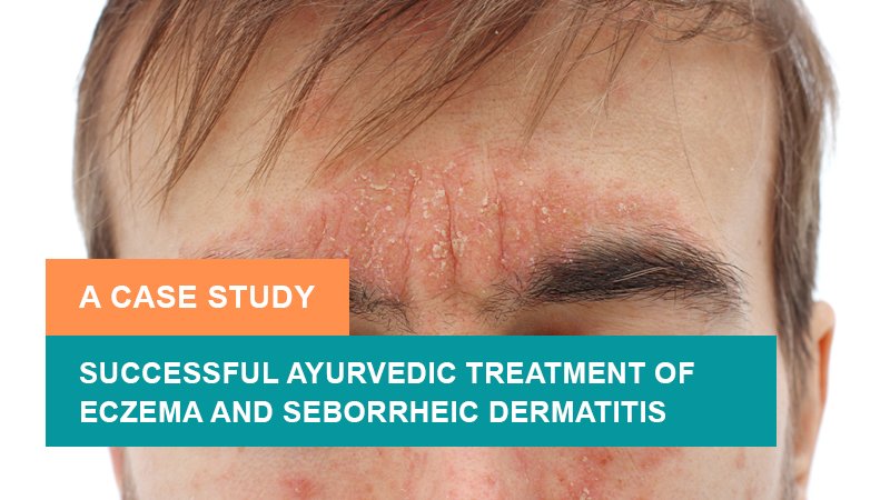 Successful Ayurvedic Treatment of Eczema and Seborrheic Dermatitis – A Case Study