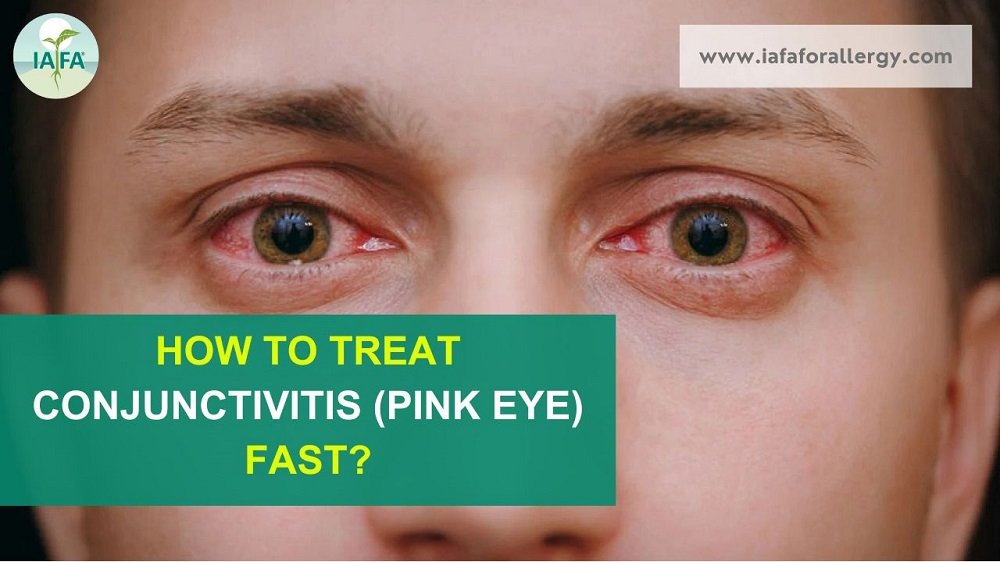 How to Treat Conjunctivitis (Pink Eye) Fast?