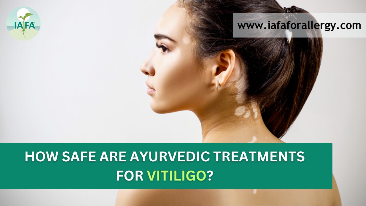ayurvedic medicine for vitiligo