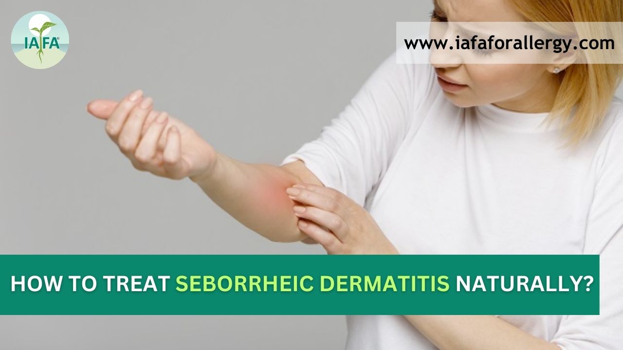 Treat Seborrheic Dermatitis Naturally