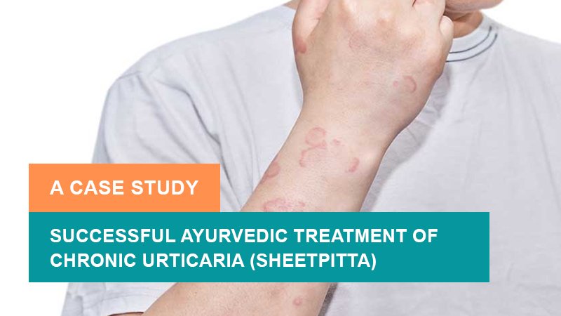 Successful Ayurvedic Treatment of Chronic Urticaria (Sheetpitta) – A Case Study