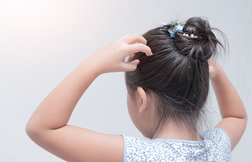 Remove Head Lice (Krimi) | IAFA