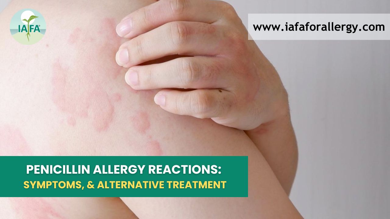 Penicillin Allergy Reactions Symptoms And Alternative Treatment Penicillin Allergy Reactions Symptoms And Alternative Treatment