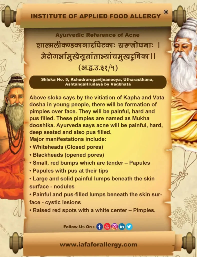 Ayurvedic Reference of Acne Vulgaris
