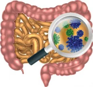 Crohn's Disease Natural Treatment - Causes, Symptoms and More