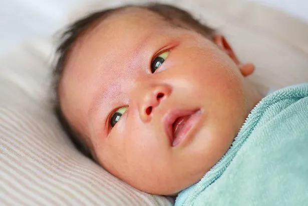 Jaundice in children